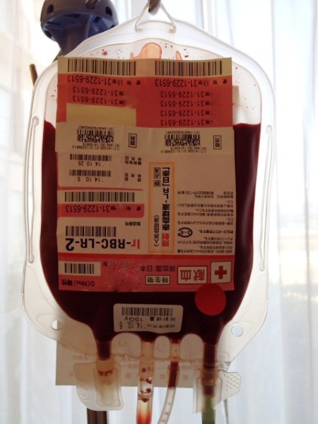 赤血球輸血
